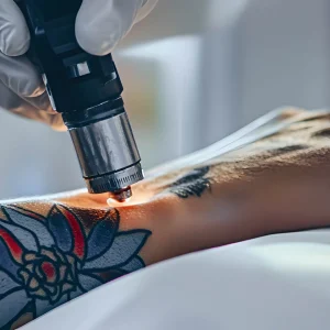 la-mano-del-maestro-sostiene-la-maquina-laser-en-el-tatuaje-del-cliente-el-concepto-de-la-eliminacion-de-tatuajes-con-laser